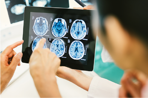 engineers pointing to brain scan on ipad