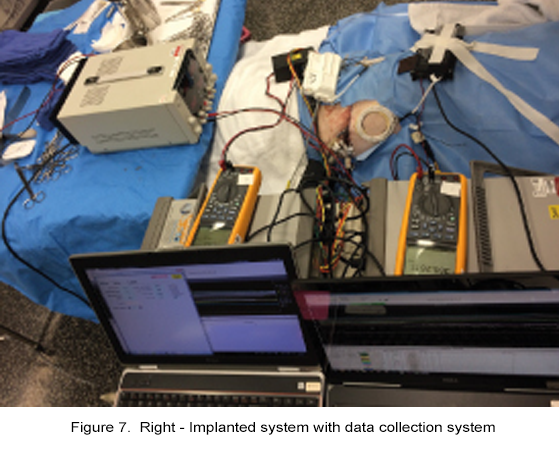 figure 7b implanted system with data collection system
