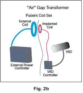 figure 2b schematic representation of air gap transformer patient coil set