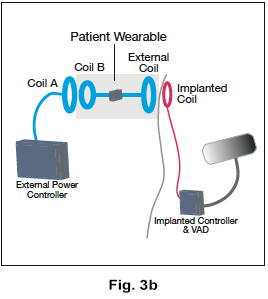 figure 3b schematic representation of patient wearable configuration