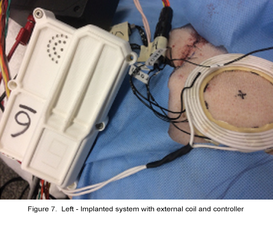 figure 7a implanted system with external coil and controller