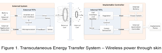 figure 1 transcutaneous energy transfer system