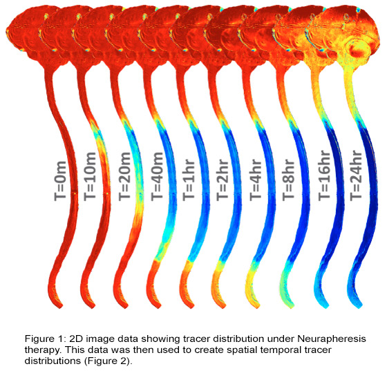 2d image data of tracer distribution under neurapheresis therapy
