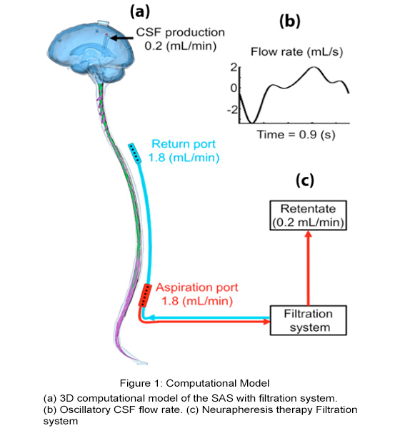 computational model
